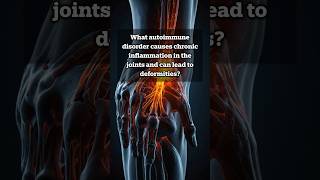 What causes deformities and inflammation in the joints anatomyfacts quizgames quiz [upl. by Ecyrb]