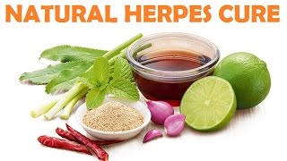 Herpes Cure  Natural Home Remedies For Herpes [upl. by Enyawd]