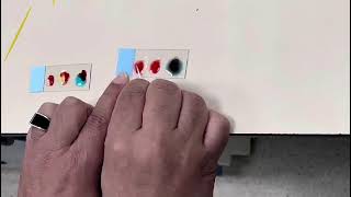 Determination of Blood Groups By Prof Dr Mohammad Yosof [upl. by Winton]