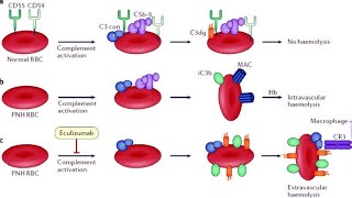 Paroxysmal nocturnal hemoglobinuria PNH [upl. by Syman327]