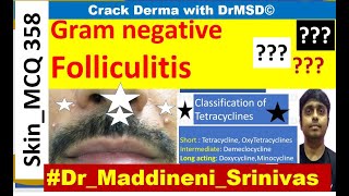 Gramnegative folliculitis  TETRACYCLINES  Pustules  ISOTRETINOIN  Anterior nares  Teratogenic [upl. by Naened]