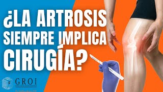 ¿La artrosis siempre implica cirugía 🤔💥🦵 MitosArtrosis artrosisderodilla artrosis artroscopia [upl. by Lokim]