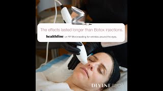 Divine Pro NonSurgical Facelift  Revolutionary AntiAging Treatment with Real Results [upl. by Deery]