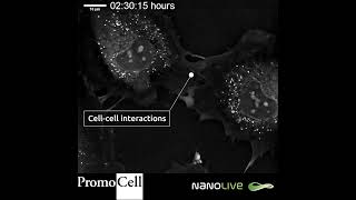 Protrusions in Human Umbilical Vein Endothelial Cells with Nanolive imaging [upl. by Ysor]