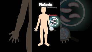 Malaria amp life cycle of plasmodium 🦟 neetbiology humanhealthanddisease neet pw viralshorts [upl. by Zeiger]