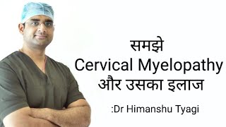 समझे Cervical Myelopathy और उसका इलाज [upl. by Ann]