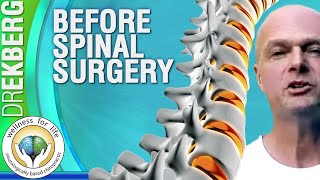 Before You Have Spinal Surgery [upl. by Renault455]