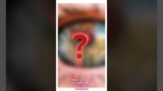 Peripheral Iridotomy In eye optocruisers eyecare optometry ophthalmology viral youtube [upl. by Eiblehs]