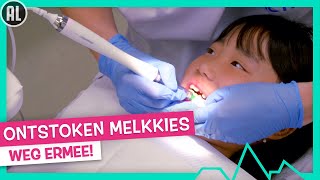 ONTSTOKEN MELKKIES TREKKEN 🦷  TOPDOKS [upl. by Frissell532]