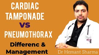 Cardiac Tamponade vs Tension Pneumothorax difference and How to do management [upl. by Akirdnas]