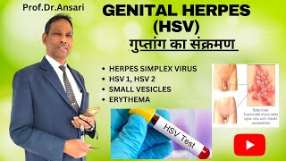 Genital herpes  HSV  Herpes virus  Herpes cure  Small vesicles  with english subtitle [upl. by Ikkir]