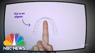 SmileDirectClub Promises Easy Teeth Straightening Some Patients Report Problems  NBC Nightly News [upl. by Janot]