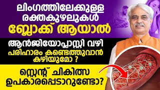 ലിംഗത്തിലേക്കുള്ള രക്തകുഴലു കൾ ബ്ലോക്ക് ആയാൽ ആൻജിയോപ്ലാസ്റ്റി വഴി പരിഹാരം കണ്ടെത്തുവാൻ കഴിയുമോ [upl. by Anstus964]