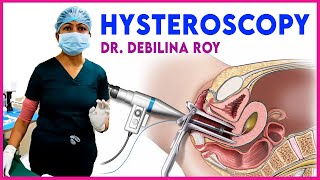 Explaining about hysteroscopy  Our specialist DrDebilina Roy  Iswarya fertility centre Kolkata [upl. by Deenya272]