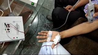 EMG test demonstration  Electromyography EMG [upl. by Quartis]