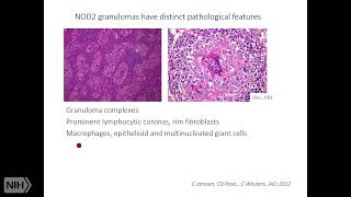 Monogenic Granulomatous Inflammatory Diseases [upl. by Whitman858]