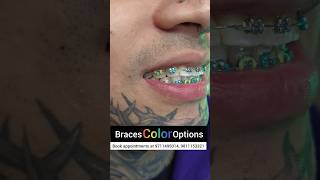 Braces Color Combinations Dr Srishti Bhatia braces smile dentist [upl. by Elleirb]