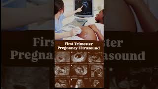 First Trimester Pregnancy Ultrasound 🤱❣️shorts pregenency ultrasound sonography ultrasonography [upl. by Drogin]