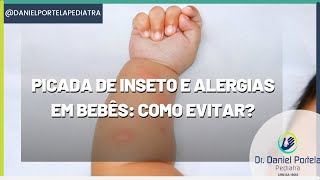 Picada de inseto e alergias em bebês como evitar [upl. by Sosanna]