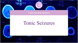 What are Tonic Seizures [upl. by Ulrika]