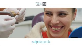 SDI pola  Amys tooth whitening journey [upl. by Nollid121]