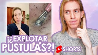 Como NO tratar los granos con pus  Recomendación de un Dermatólogo shorts [upl. by Enaz]