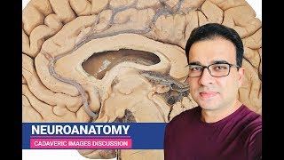 NEUROANATOMY CADAVERIC IMAGES DISCUSSION [upl. by Ranee]