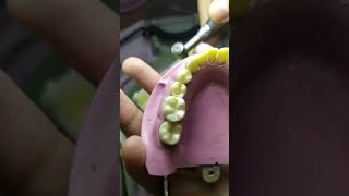 Class one cavity preparation for amalgam restoration lower 6  Arabic [upl. by Lisette]