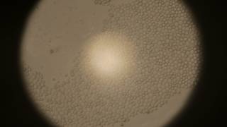 Yeast cells under the microscope [upl. by Araik]