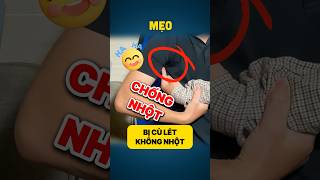 MẸO 472  Cách chống nhột khi bị cù lét cười như điên  How to prevent tickling funny mèovuinhộn [upl. by Yzzo]