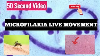 Microfilaria Live Movement Video  In fresh Blood collected at night [upl. by Jona]