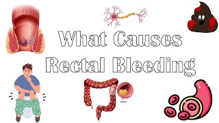 What Causes Per Rectal Bleeding Major Causes Of Blood In Stools Rectal Bleeding Causes [upl. by Sutniuq995]