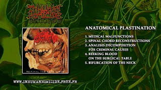 ANATOMICAL PLASTINATION  Removal the Dead Flesh FULL ALBUM 2015  Pathological deathgrind [upl. by Ingra164]