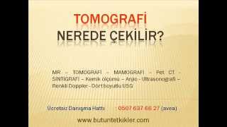 Tomografi Nerede Çekilir Tomografi Nedir BT Çekimi Tomografi Merkezleri [upl. by Adnilev]