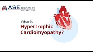 What is HCM and Who is at Risk for HCM [upl. by Ahsenor]