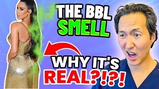 Plastic Surgeon Reacts to the BBL SMELL Why BBLs Stink [upl. by Kcirdahc]