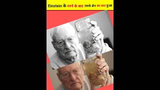 Einstein brain story [upl. by Uttica]