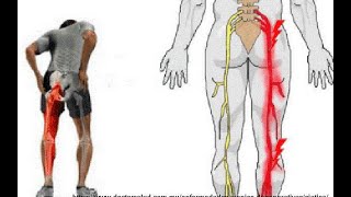 PROBLEMAS DE COLUMNA VERTEBRAL [upl. by Katleen]