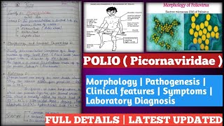 polio  poliomyelitis in hindi  polio vaccination  polio disease in hindi  polio in hindi [upl. by Crispen482]