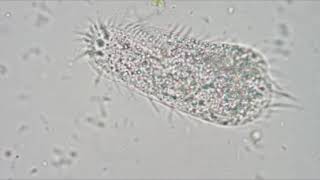 Microscope images  protozoans C elegans and Gramstained bacteria no audio [upl. by Congdon]