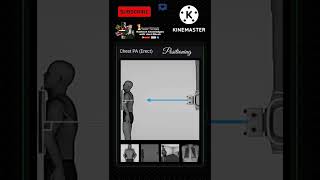 How to do Chest XRay PA view  XRay Positioning radiology xray positioning shorts chest [upl. by Noiztneb]