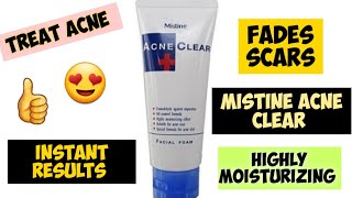 Mistine Acne Clear Foaming Wash Honest ReviewBest for treating Acne without drying out your skin [upl. by Airtemed502]