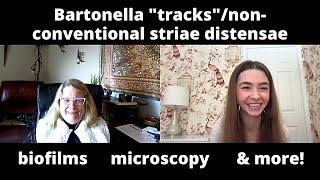 Bartonella tracksnonconventional striae with Dr Marna Ericson  biofilms microscopy [upl. by Theis579]