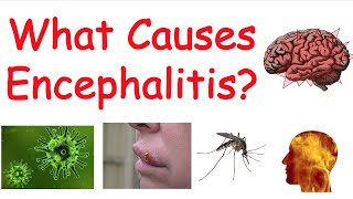 Encephalitis Brain Inflammation  Causes Symptoms Diagnosis Treatment [upl. by Cavill209]