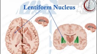 Brain Anatomy 13 Basal Ganglia 2 Lentiform NucleusInternal CapsuleClaustrum [upl. by Yelmene]