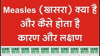 Measles खसरा क्या है और कैसे होता है कारण और लक्षण Measles Symptoms Causes [upl. by Adeys]