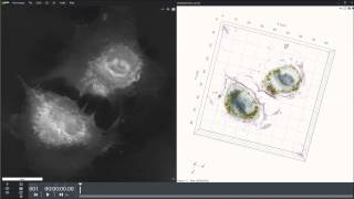 HUVEC cells with gold nanoparticles [upl. by Lundell]