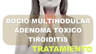 Tratamiento de hipertiroidismo Bocio Multinodular Adenoma Tóxico Tiroiditis [upl. by Hayidan]