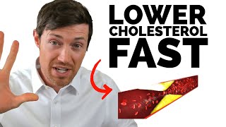 The BEST Way to Lower Cholesterol If You Have Hypothyroidism [upl. by Asserak]