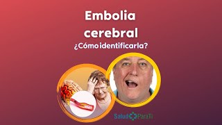 ¿QUÉ ES UNA EMBOLIA CEREBRAL [upl. by Ssac]